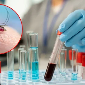Virus Shamonda en humanos síntomas
