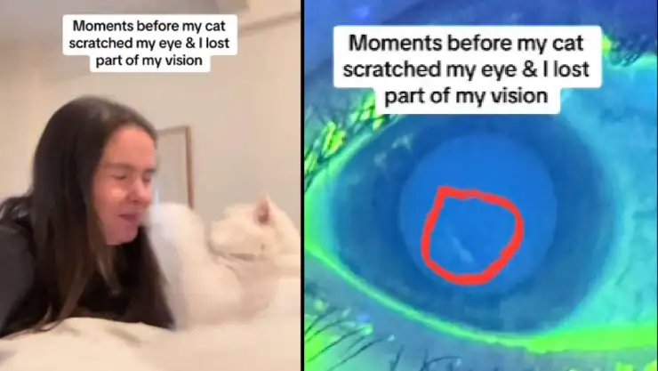 VIDEO_ Gato deja ciega a su dueña y así fue como ocurrió