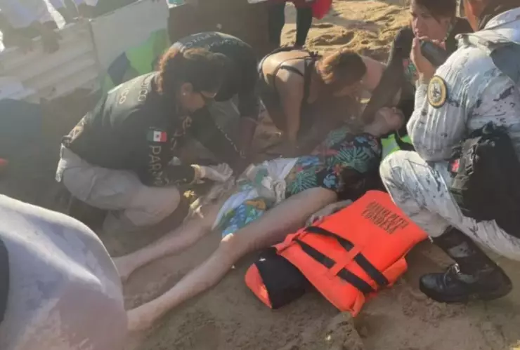 FOTO: Joven quedó gravemente herida por hélice de lancha en Acapulco ¡Le arrancó piel!