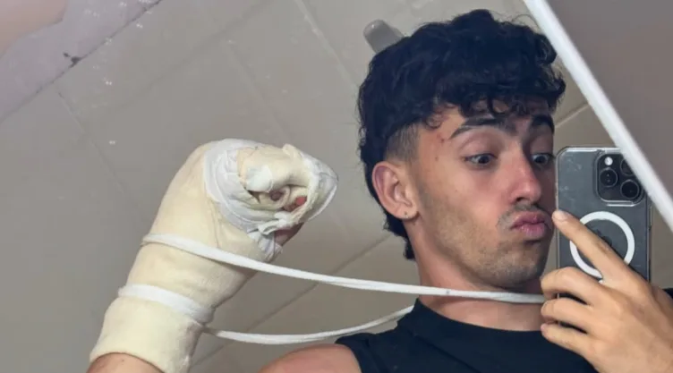 famoso-influencer-pierde-dos-dedos-sufrir-accidente.jpg