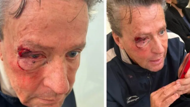 Alfredo Adame tiene miedo tras golpiza y necesita ayuda psicológica