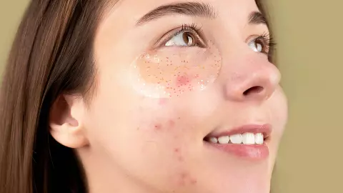 Descubre la forma adecuada de tapar un brote de acné con maquillaje
