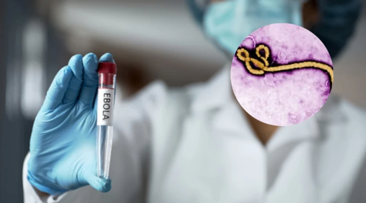 Brote de ébola activa restricciones en Estados Unidos