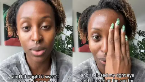 Sufre lesiones en el ojo pro ver el eclipse