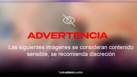 Imágenes sensibles: Hombre le arrancó el cachete a sujeto tras defender a mujer en CDMX