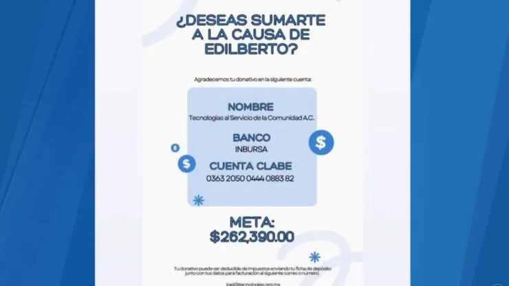 La historia de Edi: Enfrentó un asalto y perdió ambas manos, ahora necesita prótesis para seguir adelante