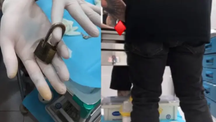 VIDEO: Se pone un candado en el pene y pierde la llave por 8 meses