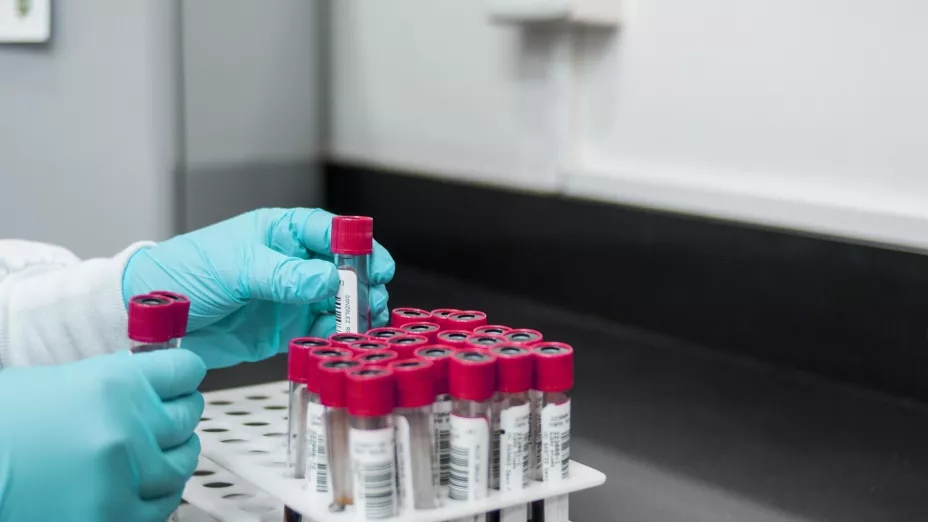 Del 27 al 29 de noviembre tomarán muestras de ADN a familiares de personas desaparecidas en Zapopan