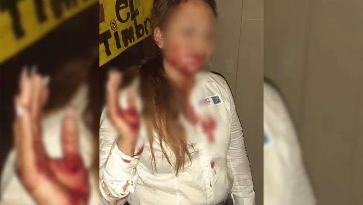 Sujeto golpea brutalmente a candidata del PAN en San Luis Potosí