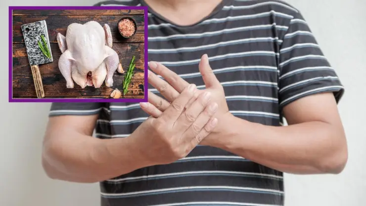 Síndrome de Guillain Barré y el pollo.