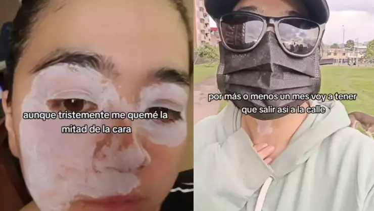 Explosion de olla express.