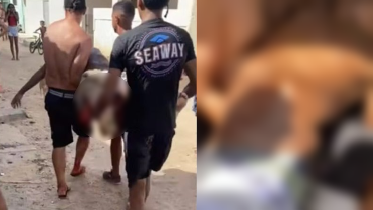 Ataque de tiburón Pernambuco