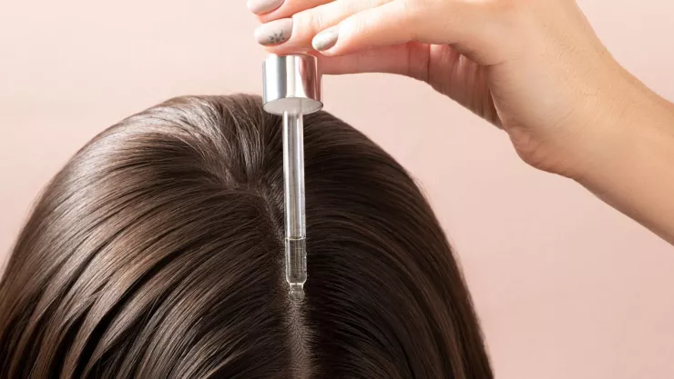 Minoxidil y su uso en el cuerpo