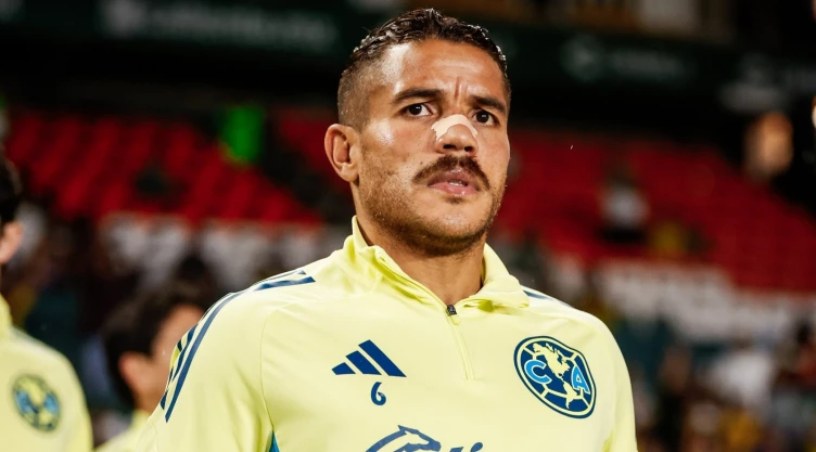 Club América dura baja