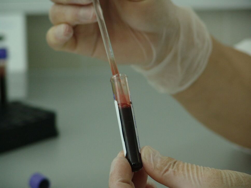 tratamiento plasma Covid-19 China.jpg