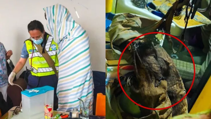 Hombre resulta con quemaduras en Lindavista, ¿qué sucedió?