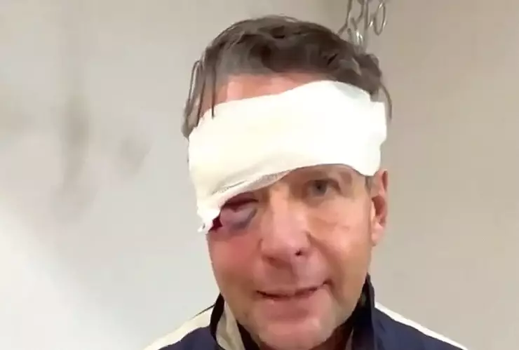 Alfredo Adame preocupa al aparecer con la cara inflamada