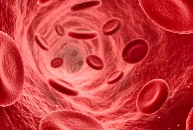 Hematohidrosis una extraña enfermedad que provoca sudor de sangre