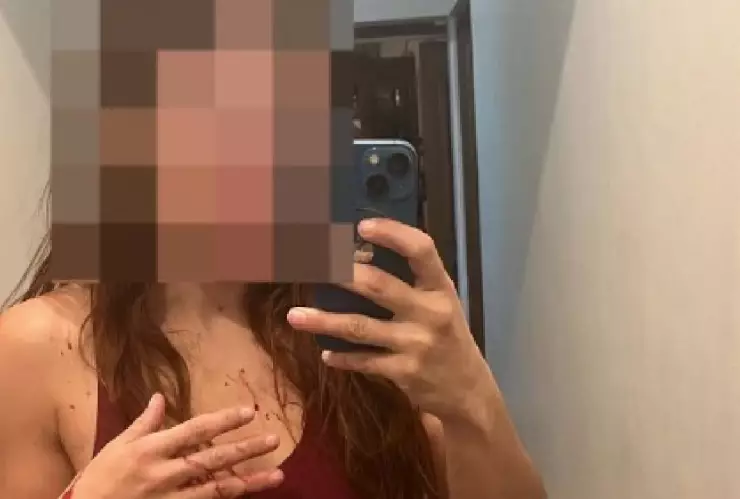 VIDEO_ Luchadora profesional Daniela López denuncia golpiza de su esposo