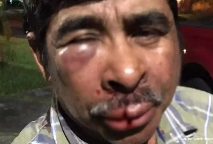 hombre mexicano golpeado miami.jpg