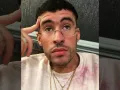 Bad Bunny Pensativo.jpg