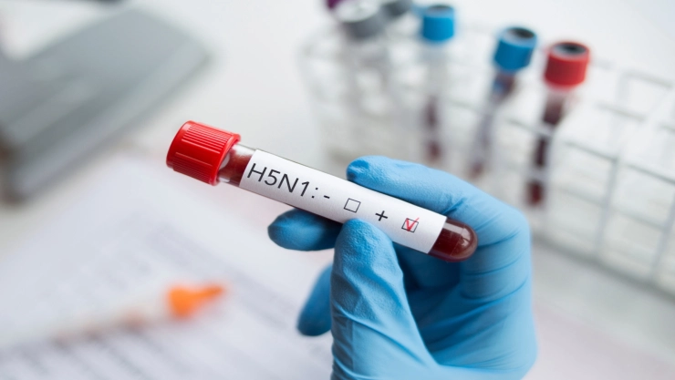 una muestra de sangre positiva con el virus H5N1