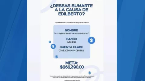 La historia de Edi: Enfrentó un asalto y perdió ambas manos, ahora necesita prótesis para seguir adelante