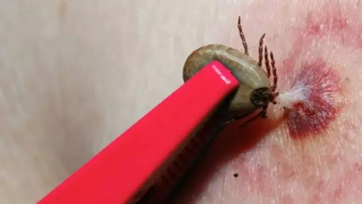 aumentan casos de alergia a la carne roja por culpa garrapata