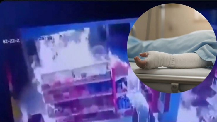 ¿Cuál es el estado de salud de Henry, niño que resultó quemado tras ir a comprar una gelatina con su papá?
