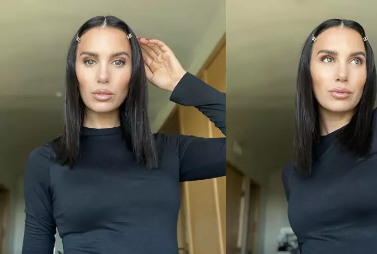 Reconocida actriz de Disney recibe un disparo en la cara durante el cumpleaños de su esposo