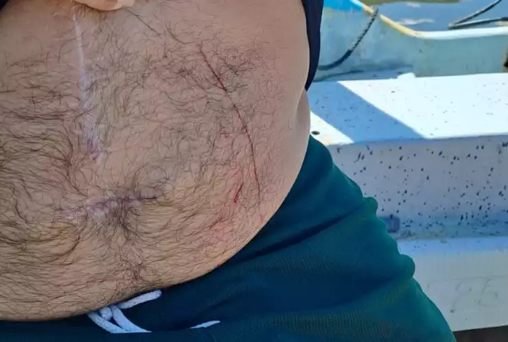 ATAQUE de lagarto contra pescador en Dzilam de bravo (FOTO)