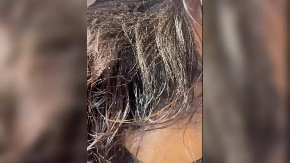 piojos nina eu
