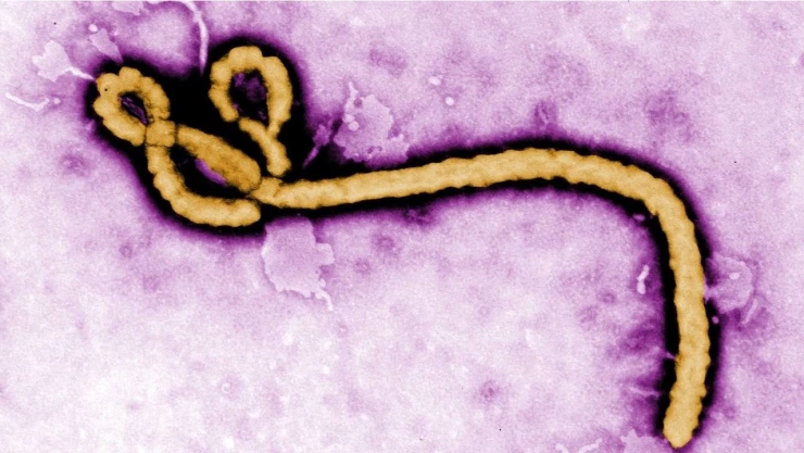 Médico estadounidense da positivo por ébola en el Congo