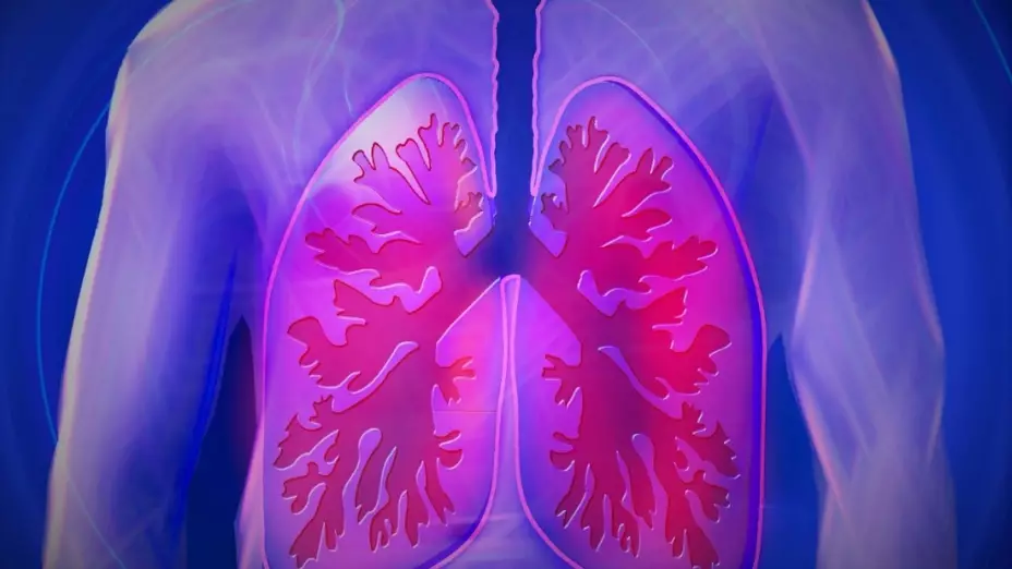 cáncer de pulmón síntomas