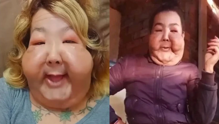 Negligencia médica produce un impactante cambio físico en reconocida influencer (1).jpg