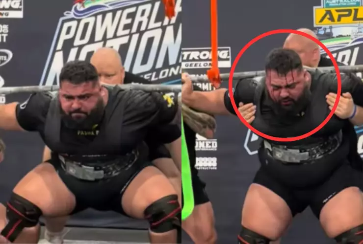 VIDEO | Levantador de pesas sangra por la cabeza durante competencia en Australia; ¿qué le pasó?