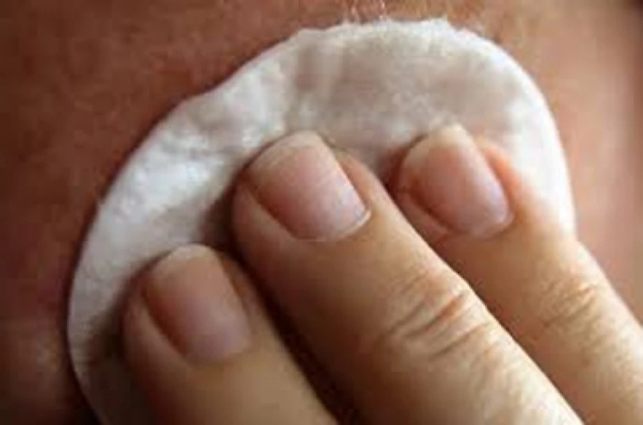 Dermatitis