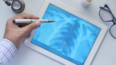 rayos X aplicación COVID-19 1.jpg