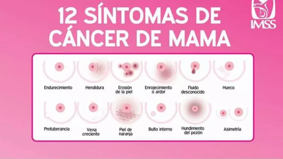 Síntomas para detectar el cáncer de mama