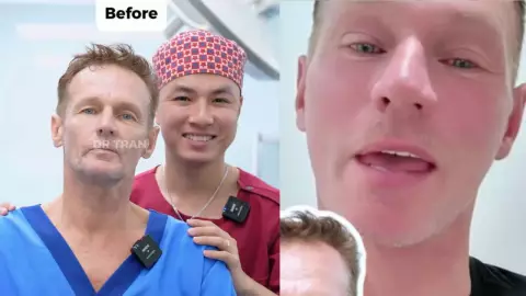 cirugía de rejuvenecimiento