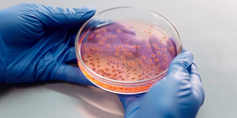 bacterias recipiente estudio