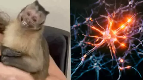 Los DELICADOS SÍNTOMAS de la tendencia neurodivergente, la enfermedad que se ha hecho viral en las últimas horas