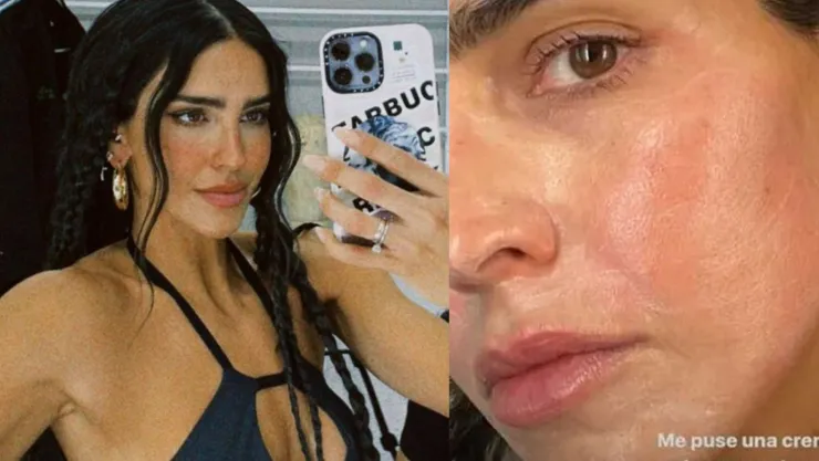 que le paso a barbara de regil en la cara