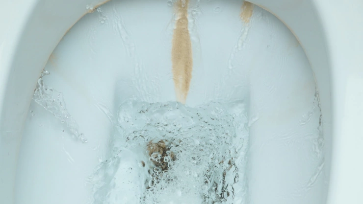 ¿Sal en el inodoro? Esto explica un especialista