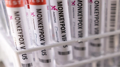 viruela del mono México 788 casos