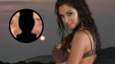 Dorismar: Así luce su nueva nariz tras mala cirugía que le deformó el rostro