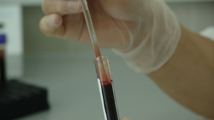 El descubrimiento podría ayudar a terminar con la pandemia del VIH al prevenir la transmisión del virus en poblaciones de alto riesgo. Imagen: Pxhere