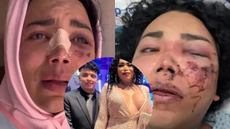 “Pensé que todo era un sueño”_ Paola Suárez reaparece tras sufrir agresión de su novio.jpg