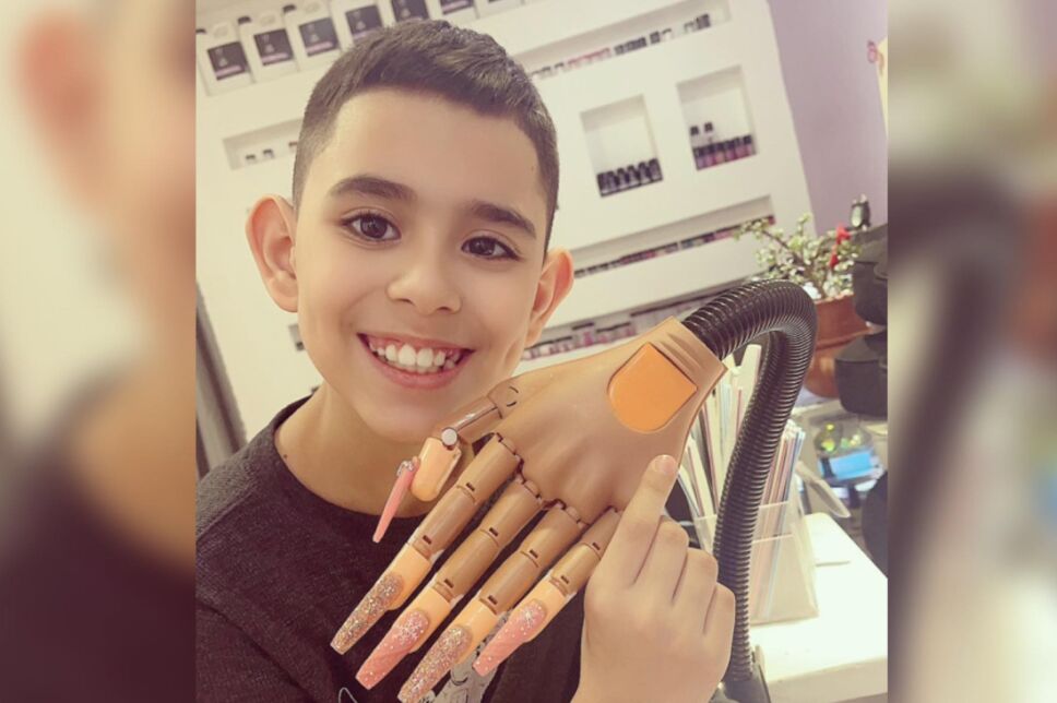 Uñas hermanito operación