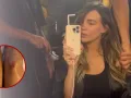Belinda sorprende al compartir impactante FOTO de sus heridas por caída.jpg